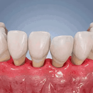 ๐บ๐ธ๐จโโ๏ธ๐ฆท๐ก๏ธ๐๐๐บ๐ฅ๐ฒ๐ป๐ฒ๐ Periodontal Repair Gel