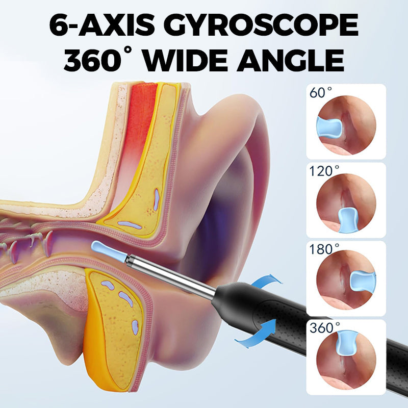 💥Surprise 50% Off！Limited Time Offer👂Visualized Electric Ear Wax Removal Tool