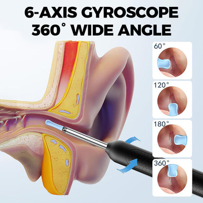 💥Surprise 50% Off！Limited Time Offer👂Visualized Electric Ear Wax Removal Tool
