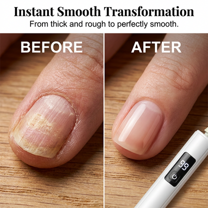 💅✨ 49% OFF! Professional Electric Nail Polisher – Smooths thick nails, 99-speed display. Multiple heads for shaping & buffing. Salon at home! 🌟💎